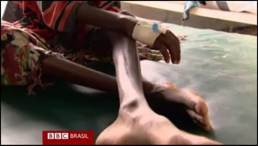 Chifre da África: Fome, Miséria e Morte