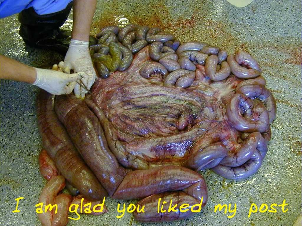 http://i213.photobucket.com/albums/cc263/jesusluvspegging/intestines1.jpg